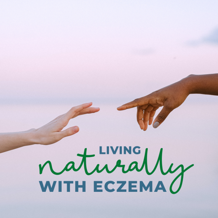 Living Naturally With Eczema
