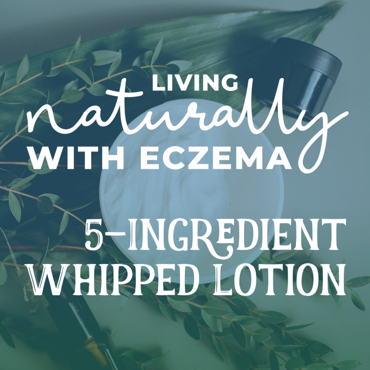 Living Naturally With Eczema: Simple 5-Ingredient Whipped Lotion